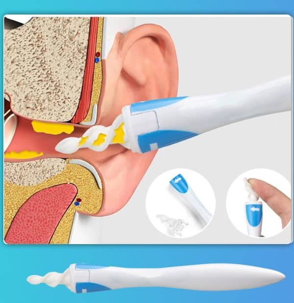 מכשיר לניקוי אוזניים עם תמונה של אוזן של אדם.